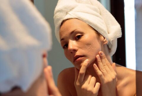 large-main_skin_with_scars